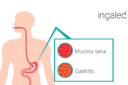 gastritis crónica